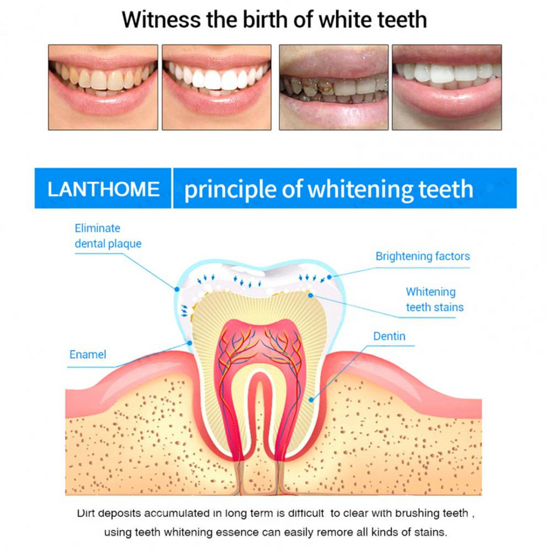 White Essence - Pluma para blanquear los dientes